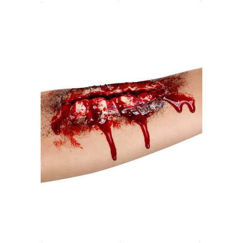 Open Wound Scar  with Adhesive